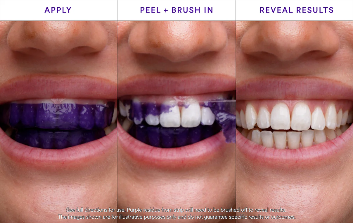 Buy One Get One Free - V34 Whitening Strips