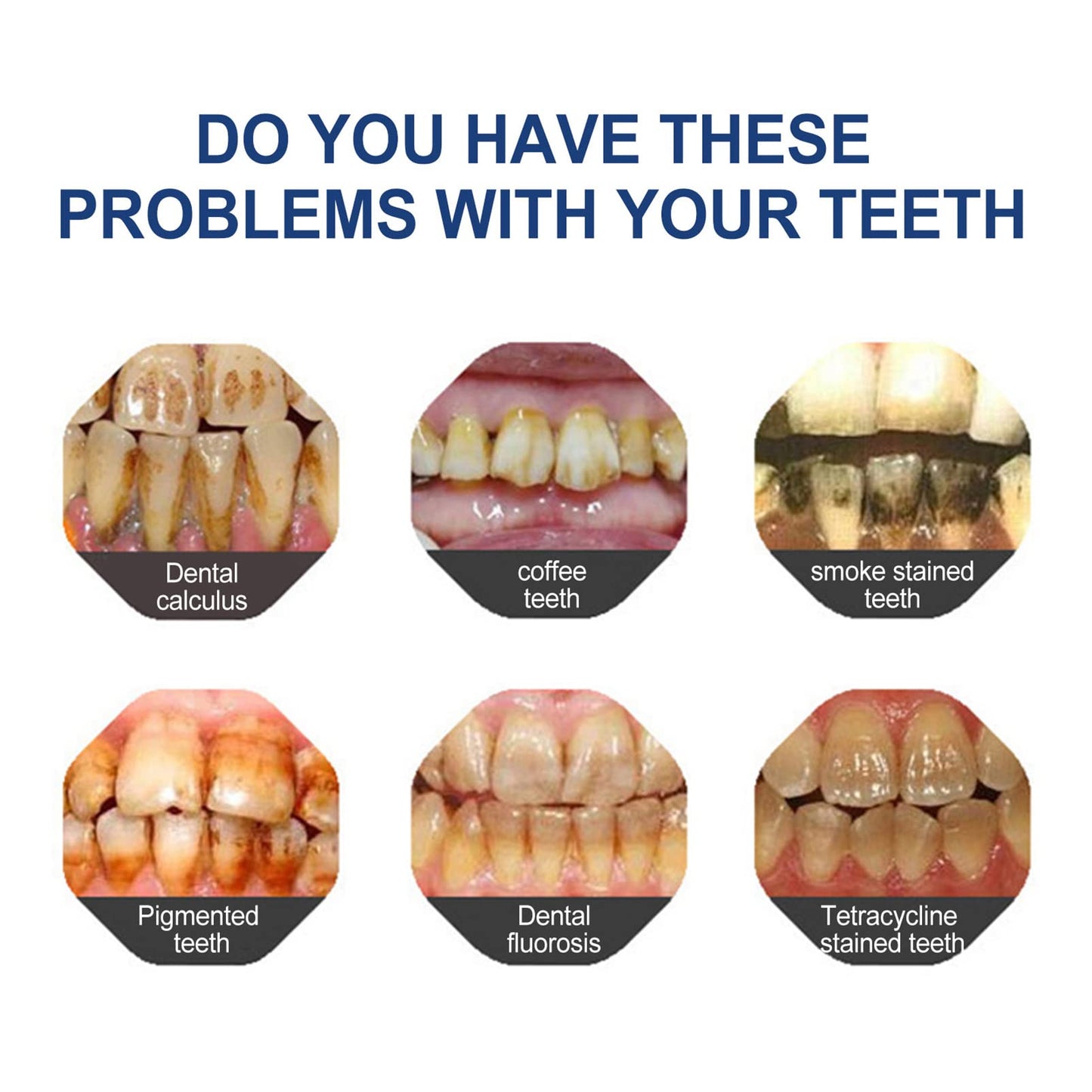 🔥🔥Final 12 Hours: 60%OFF🎁 BBOJI™ Fluoride-Free Hydroxyapatite Toothpaste 💎 Your Smile, Naturally Brighter!(副本)