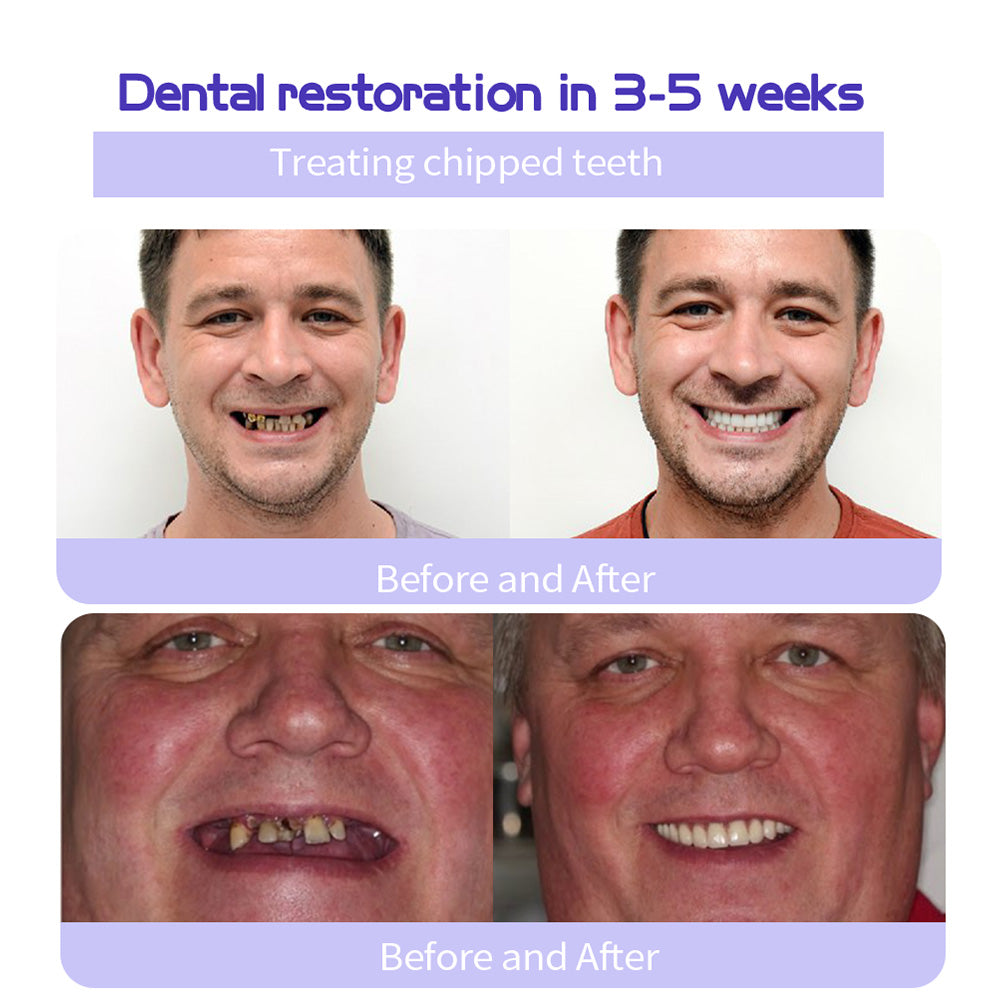 🔥🔥Final 12 Hours: 60%OFF🎁 BBOJI™ Fluoride-Free Hydroxyapatite Toothpaste 💎 Your Smile, Naturally Brighter!(副本)