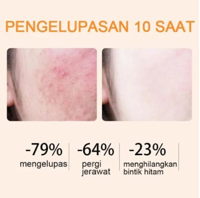 “BBOJI™ Orange Enzyme Exfoliating Gel — The Gentle Miracle Your Skin Has Been Crying Out For”（🔥🔥）