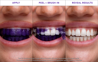 Buy One Get One Free -  V34 Whitening Strips
