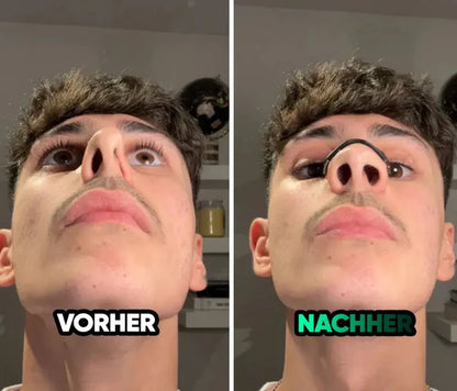 LOVILDS™ Magnetic Nose Patch – Breathing Expander Keeping You Breathing, Naturally.