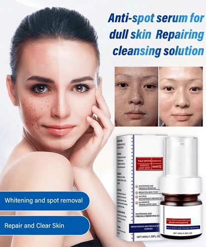“Dark Spot Eraser for Freckled Skin – Deep Repair Serum That Fights Back Against Years of Sun Damage”