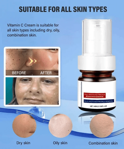 “Dark Spot Eraser for Freckled Skin – Deep Repair Serum That Fights Back Against Years of Sun Damage”