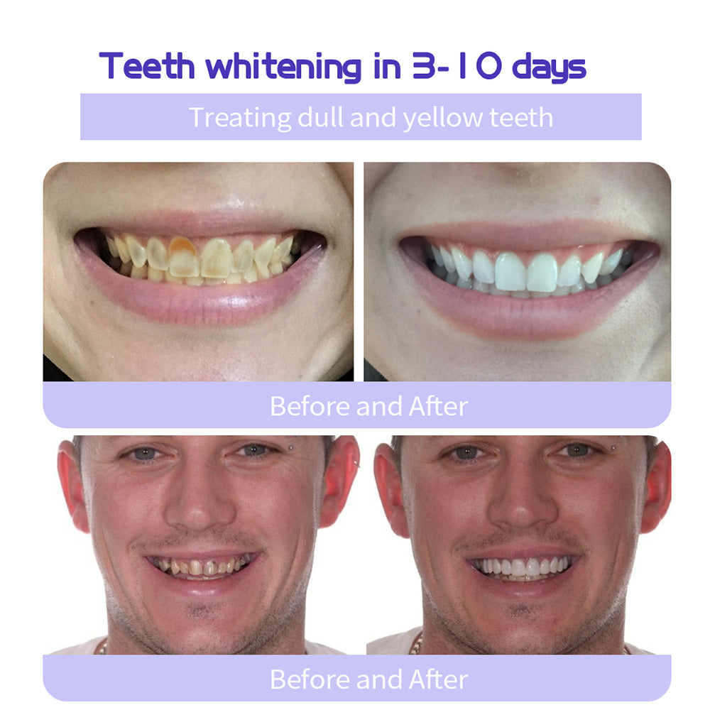 🔥Final 12 Hours: 81%OFF🎁 BBOJI™ Fluoride-Free Hydroxyapatite Toothpaste 💎 Your Smile, Naturally Brighter!