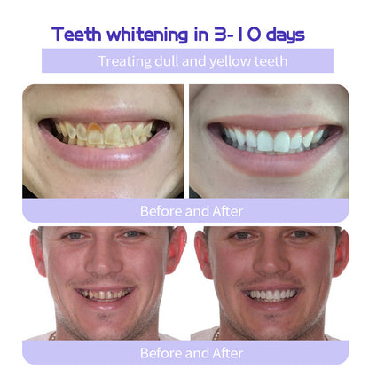 🔥Final 12 Hours: 81%OFF🎁 BBOJI™ Fluoride-Free Hydroxyapatite Toothpaste 💎 Your Smile, Naturally Brighter!