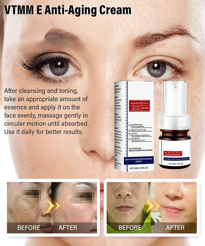 “Dark Spot Eraser for Freckled Skin – Deep Repair Serum That Fights Back Against Years of Sun Damage”