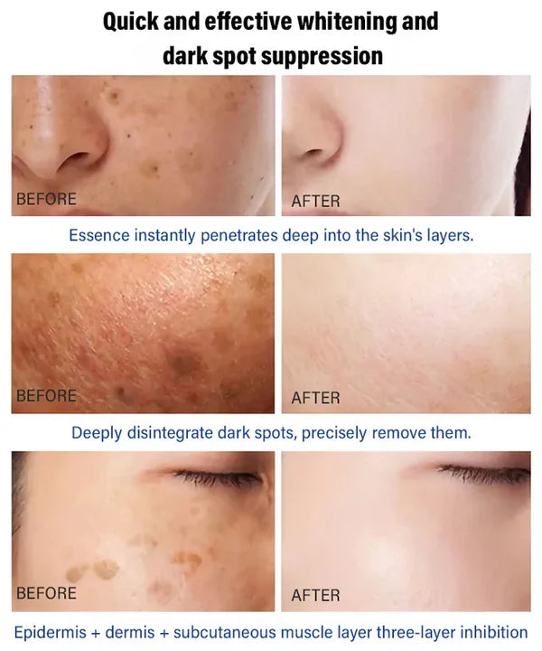 “Dark Spot Eraser for Freckled Skin – Deep Repair Serum That Fights Back Against Years of Sun Damage”