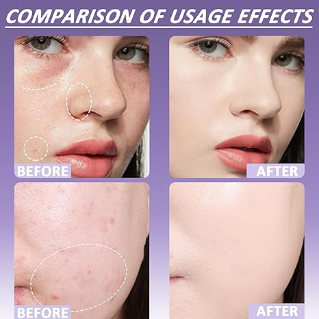 Final 3 Hours: 60%OFF-Evanesce Soft Matte Cream Concealer with Brush FREE !