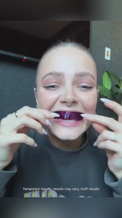 Buy One Get One Free -  V34 Whitening Strips